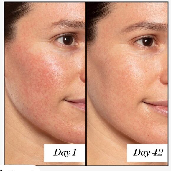 Bundle 6 -Sunday Riley A+ Retinoid Serum - 5 ml each = Full Size $85 Retail. New - Picture 7 of 11